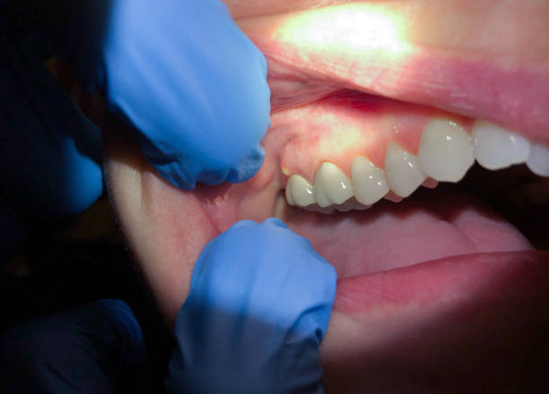 Best Emergency Denture Repair in Piney Green, NC